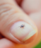 A New Virus and a Shifting Map: What’s Changing About Ticks in Britain